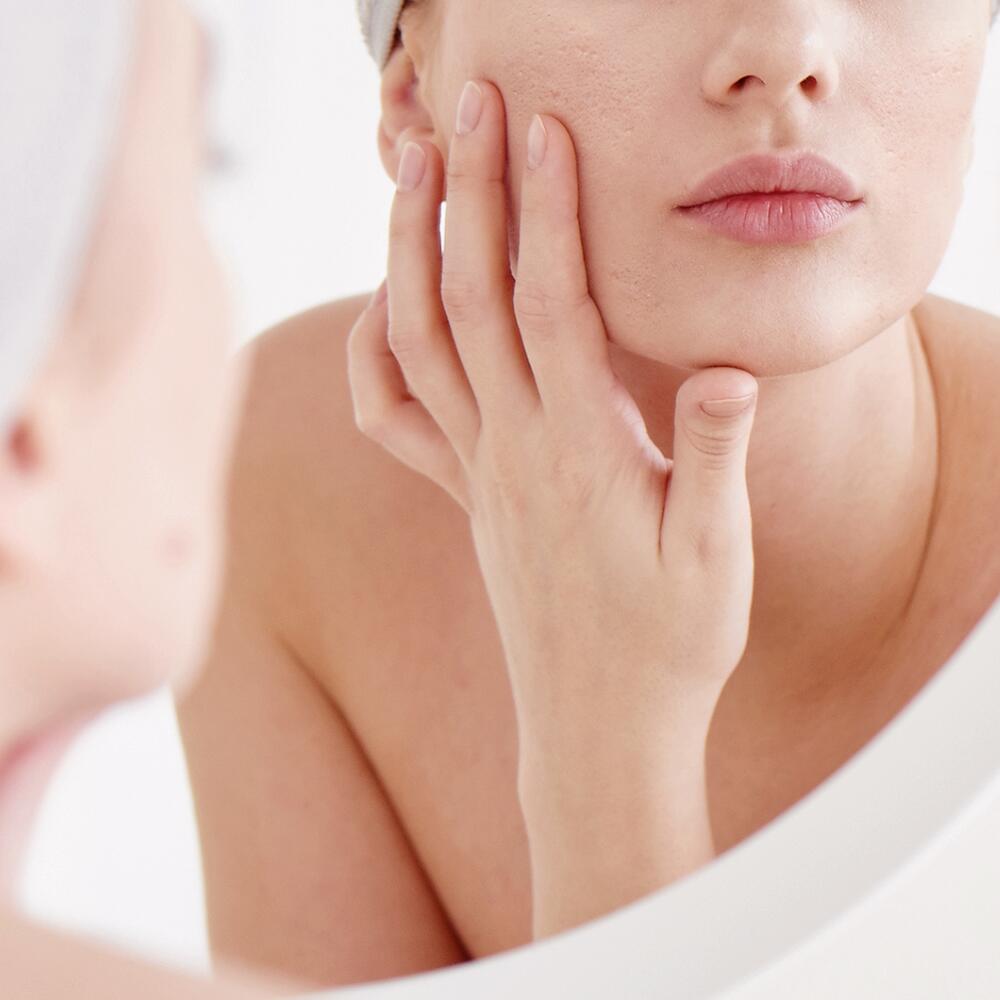 Scars caused by acne